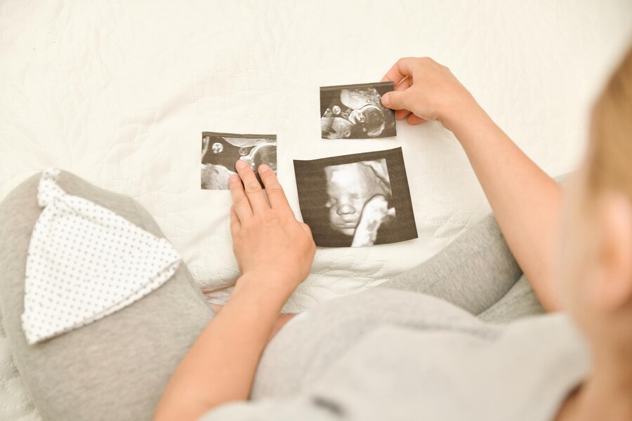 Pregnant woman holding 4D ultrasound image expectating child