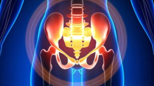 Illustration of pelvic floor anatomy showing muscles and organs involved in pelvic floor dysfunction and therapy options.