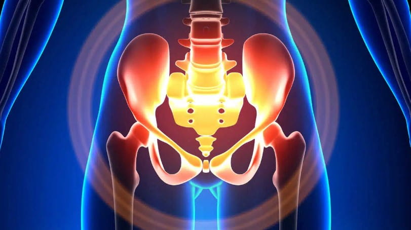 Illustration of pelvic floor anatomy showing muscles and organs involved in pelvic floor dysfunction and therapy options.